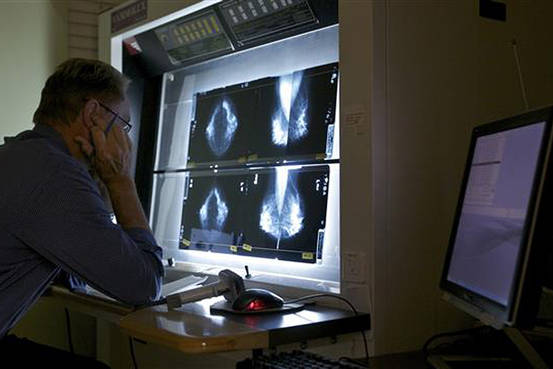 マンモグラフィー推奨45歳に引き上げ…米指針 2015年10月22日 12時30分