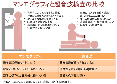 乳がん マンモグラフィー＋超音波で発見率１・５倍に