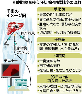 腹腔鏡手術を学会報告、肝切除の前後データ登録 2015年11月12日 03時06分