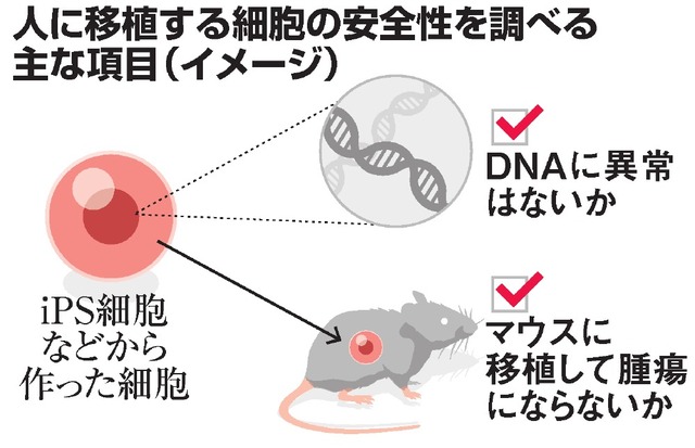 ｉＰＳ移植に安全基準、厚労省が研究班 2015年11月17日 16時54分