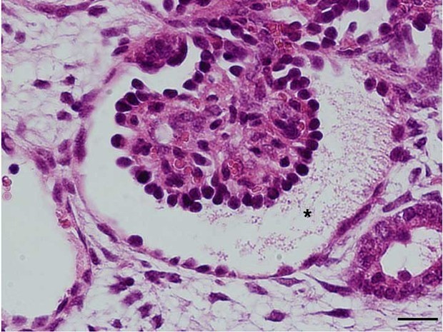 ｉＰＳ細胞：マウスに移植した腎臓組織の成長成功 熊本大