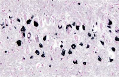 認知症に効果 理研などマウス実験 神経細胞減少防ぐ