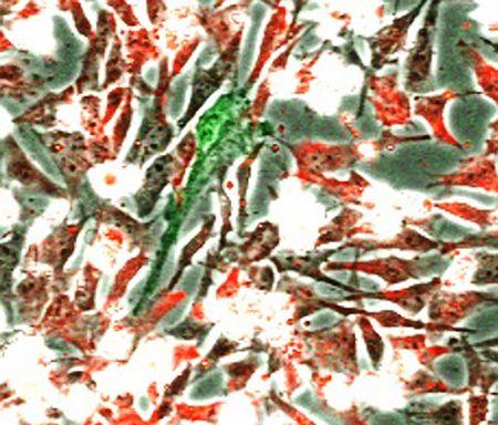 京大、ｉＰＳの元になる新細胞を作製 創薬研究に貢献