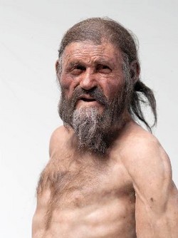 アイスマン、ピロリ菌に感染 - 5千年前、胃炎に悩む?