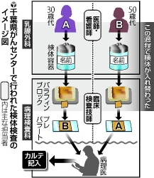 乳房全摘事故、病理診断前に検体入れ替わる 2016年01月09日 10時53分