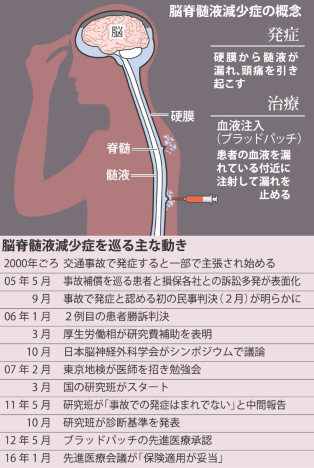 髄液漏れ治療法、保険適用へ 患者ら悲願達成 医学研究前進の10年
