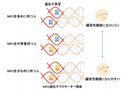 「騒音性難聴」予防につながる遺伝子を発見 2016年01月19日 18時11分