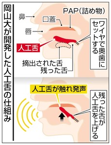 「人工舌」で発声が楽に 岡山大チーム、がん患者向けに開発