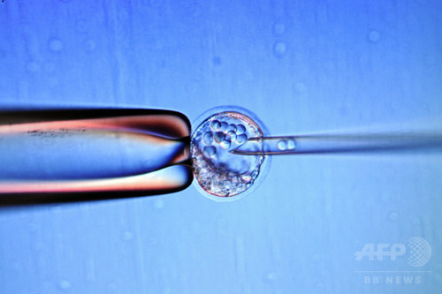 ヒト受精卵の改変、英で承認…子宮への移植は禁止
