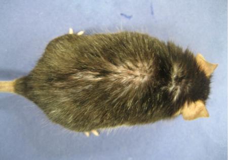 加齢による薄毛、コラーゲン減が要因 東京医科歯科大が解明