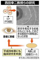 ｉＰＳ細胞から角膜作製、大阪大が成功 平成２８年度中にも臨床研究を申請へ