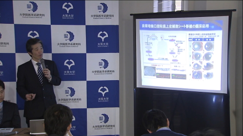 目の各部作製 ４層構造細胞群 大阪大グループ