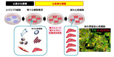 慶大、ヒトiPS細胞から高純度な心筋細胞の作製に成功 - 特殊な培養液を利用