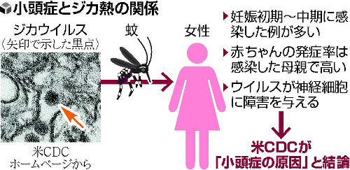 小頭症、ジカ熱が原因…米疾病センターが結論