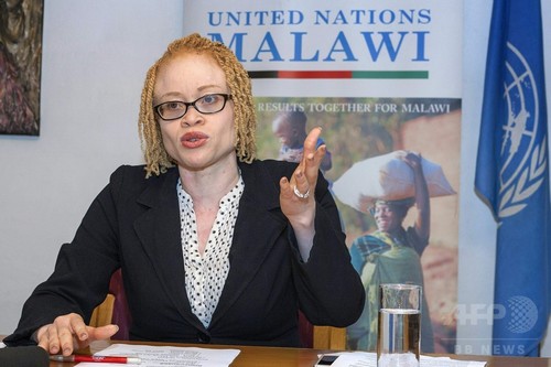 マラウイのアルビノ「組織的に滅ぼされる」危機に、国連専門家