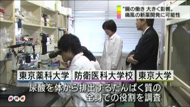 腸からの尿酸排出低下 痛風に新たな要因