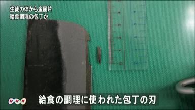 飲み込んだ包丁の破片 無事排出…男子中学生、体調は異常なし