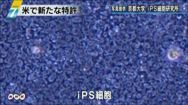 ｉＰＳ利用の薬開発に特許 京大が米国で取得