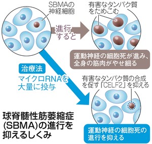 神経難病の進行を抑制 名大などが新治療法