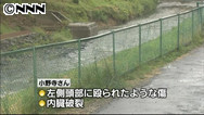 ひき逃げ？出血し倒れていた男性、搬送後に死亡