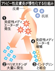 アトピー慢性化の原因解明 佐賀大など