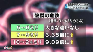 ７ミリ以上でリスク増加 脳動脈瘤で追跡調査