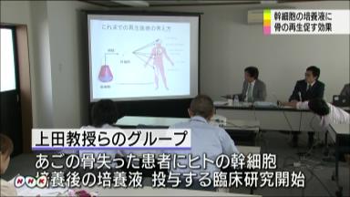 歯周病で欠けた骨を再生…名大Ｇが新手法開発